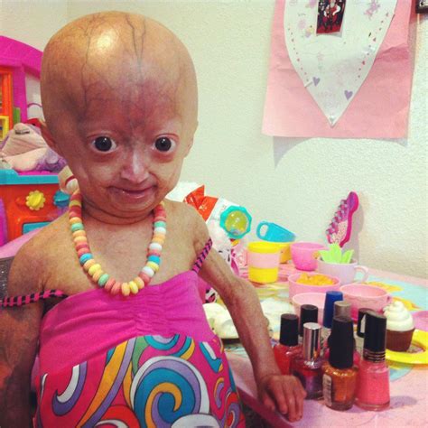 when did adalia rose pass away